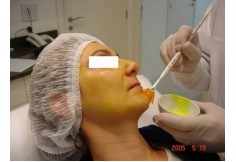 Aprimoramento em Peeling Químico e Físico - Facial e Corporal

